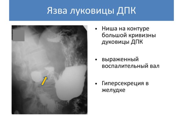 Ссылка кракен cc